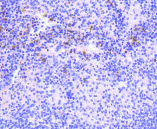 Anti-PKC beta Antibody (5T436)