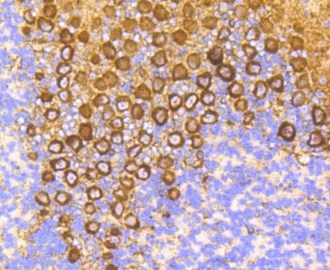 Anti-PRKCA Antibody (6S104)