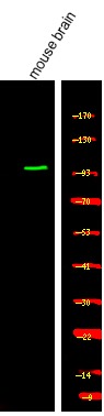 Anti-Phospho-PKG2 (Ser126) Polyclonal Antibody