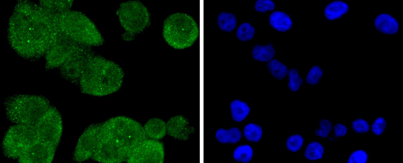 Anti-PP2A alpha/beta Antibody (6N831)