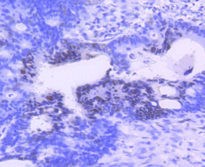 Anti-PIM1 Antibody (6F773)