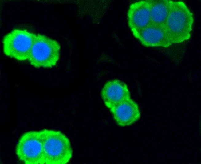Anti-PRKCA Antibody (6S104)