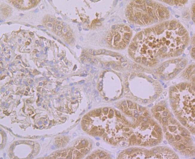 Anti-PON2 Antibody (3M227)