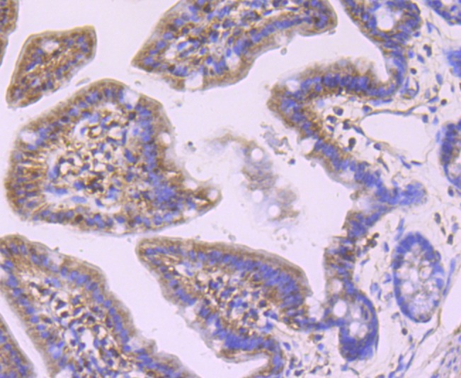 Anti-Profilin-1 Antibody (1I976)