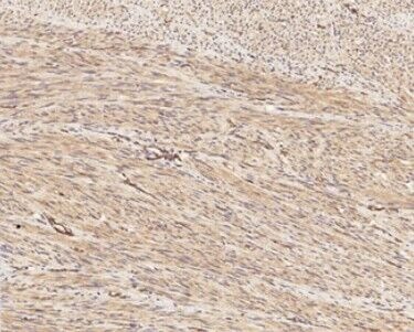 Anti-Phospho-PIK3R1 (Tyr467, 199) Polyclonal Antibody