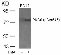 Anti-Phospho-PRKCD (Ser645) Polyclonal Antibody