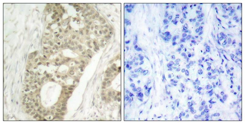 Anti-Phospho-PRKCD (Ser645) Polyclonal Antibody
