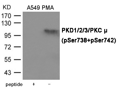 Anti-Phospho-PKD1/2/3/PKC μ (Ser738/742) Polyclonal Antibody