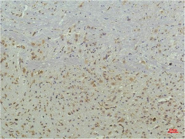 Anti-PPARD Antibody (2B812)