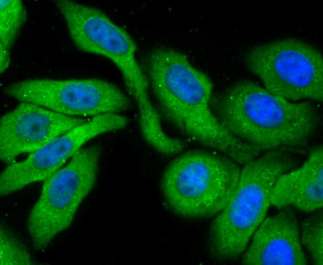 Anti-Profilin-1 Antibody (1I976)
