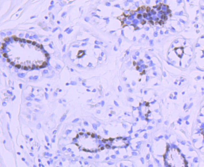 Anti-Progesterone Receptor Antibody (9Z37)