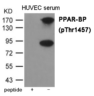 Anti-Phospho-MED1 (Thr1457) Polyclonal Antibody 2