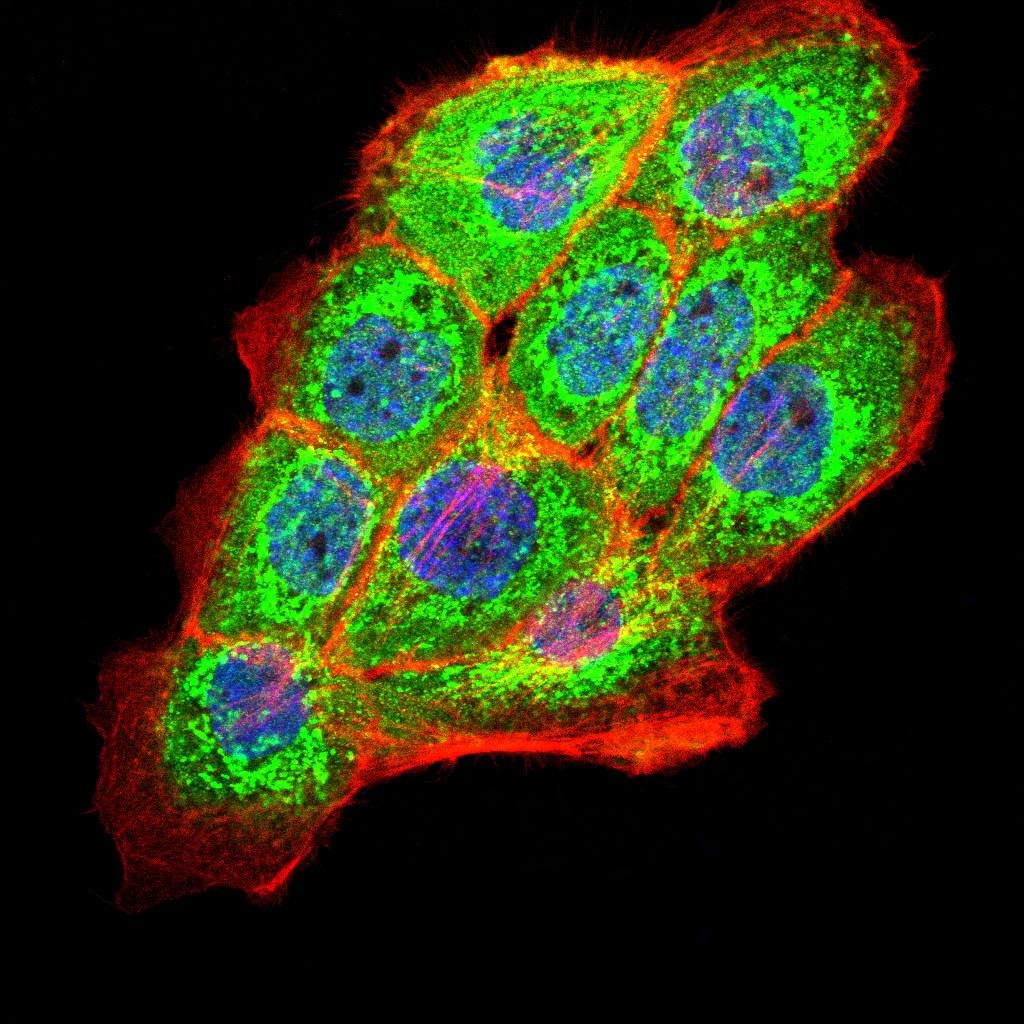 Anti-PKHD1 Antibody (4M854)