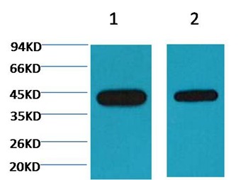 Anti-Plant actin Antibody (5Q638)
