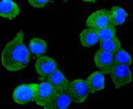Anti-RUNX1/RUNX2/RUNX3/RUNX2/RUNX3 Antibody (4N296)