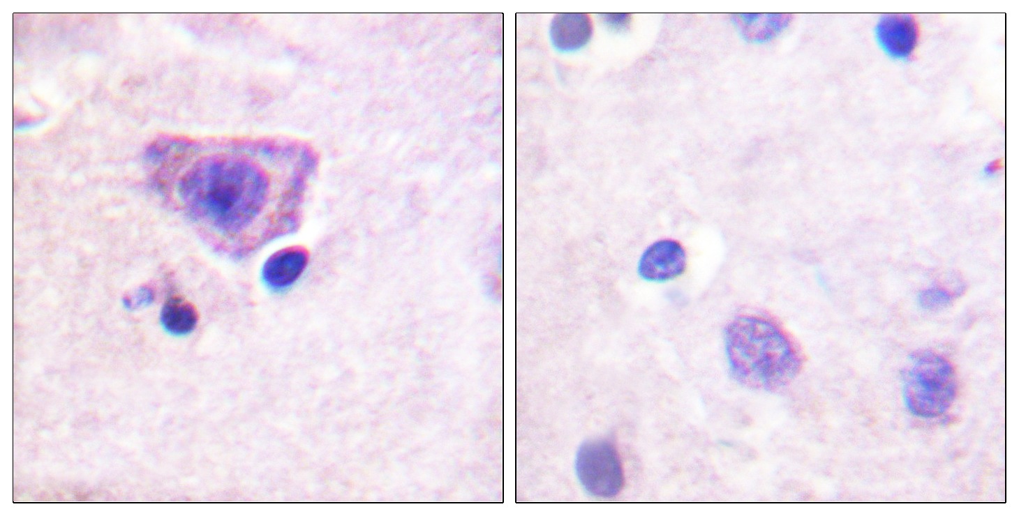 Anti-Phospho-Ryanodine Receptor 2 (Ser2808) Polyclonal Antibody