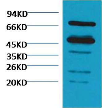 Anti-RuBisCO large subunit Polyclonal Antibody