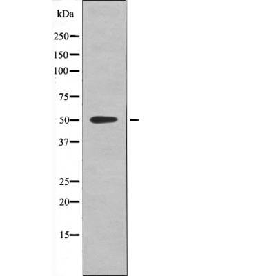 Anti-Phospho-RXR-α (Ser260) Polyclonal Antibody