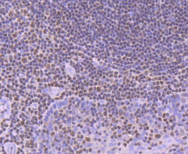 Anti-RUNX1/RUNX2/RUNX3/RUNX2/RUNX3 Antibody (4N296)