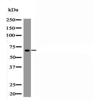 Anti-Phospho-RUNX2 (Ser340) Polyclonal Antibody