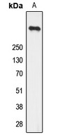 Anti-Phospho-Ryanodine Receptor 2 (Ser2808) Polyclonal Antibody 2