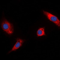 Anti-Phospho-RSK1/2/3 (Thr573/570/577) Polyclonal Antibody