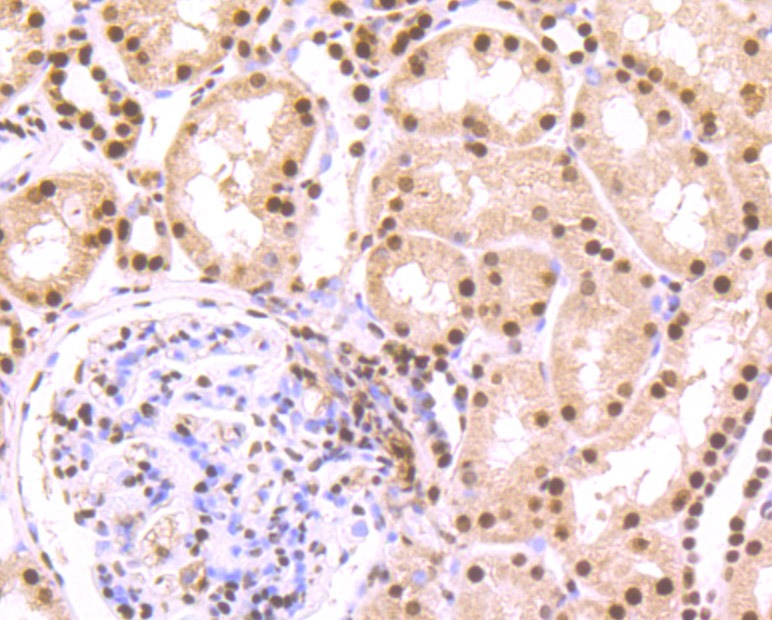 Anti-SET Antibody (3V307)