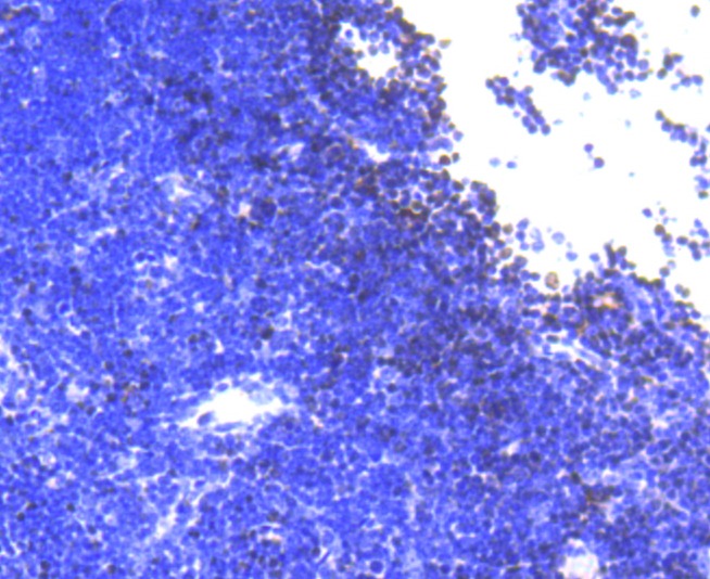 Anti-SATB1 Antibody (9Q281)