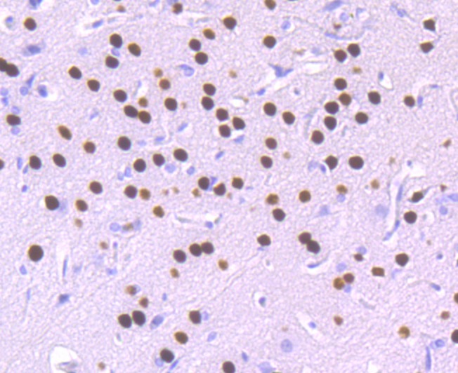 Anti-SATB2 Antibody (4X996)