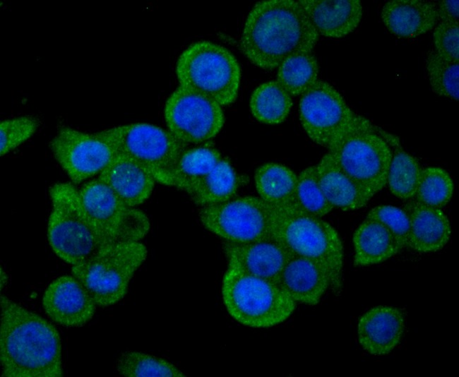 Anti-SENP1 Antibody (8Q886)