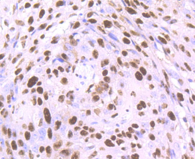 Anti-SET Antibody (3V307)
