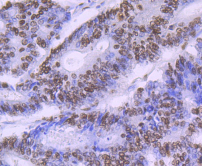 Anti-SF3B3 Antibody (4H951)