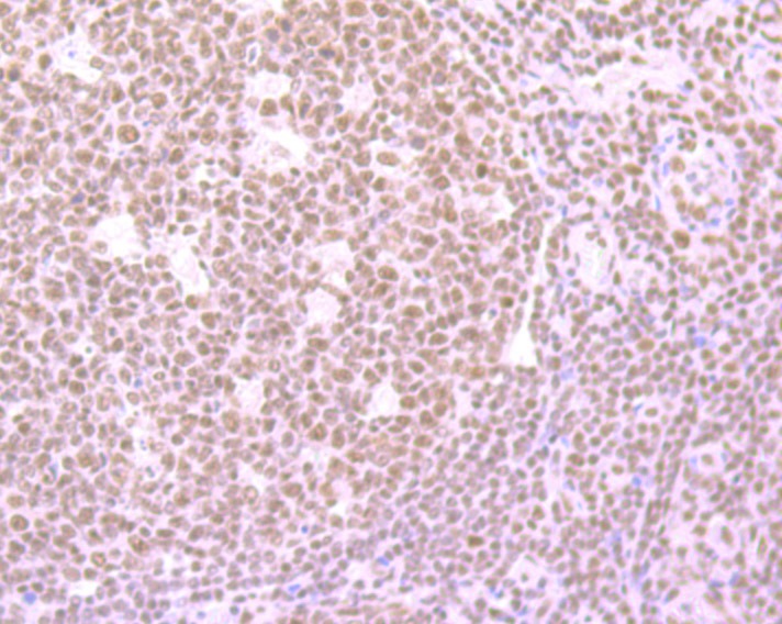 Anti-SRSF1 Antibody (4J752)