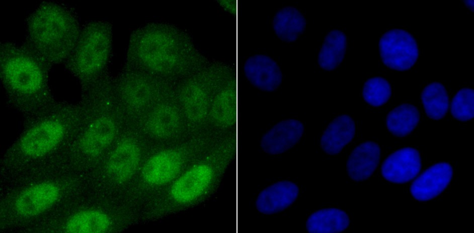 Anti-SAMHD1 Antibody (8T611)
