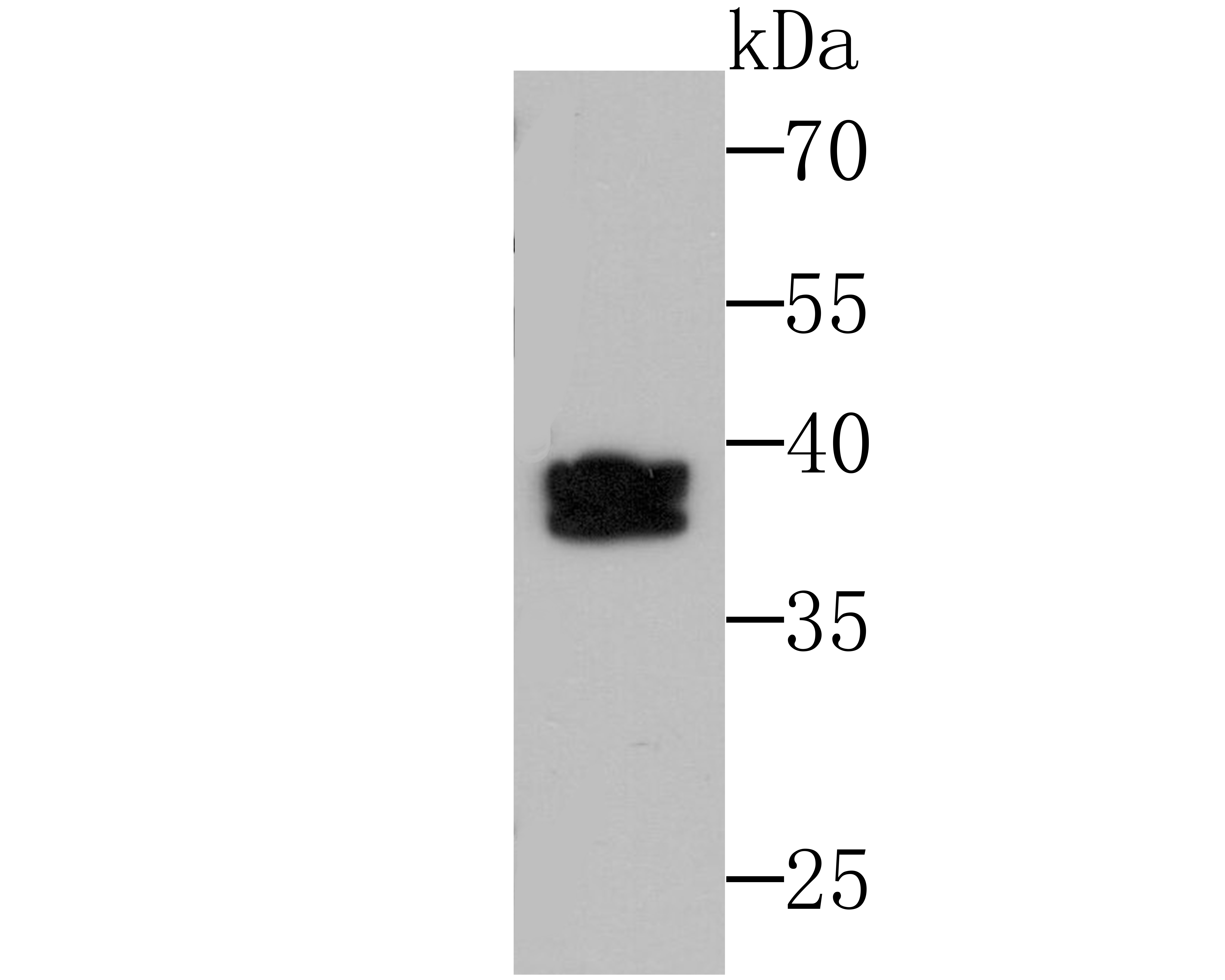 Anti-SET Antibody (3V307)