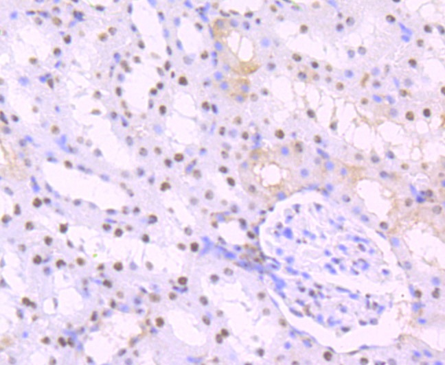 Anti-SET Antibody (3V307)
