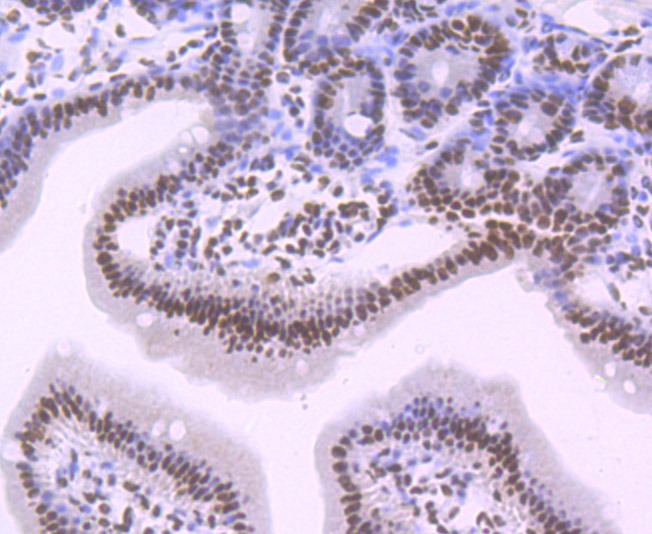 Anti-SF3B1 Antibody (5W363)