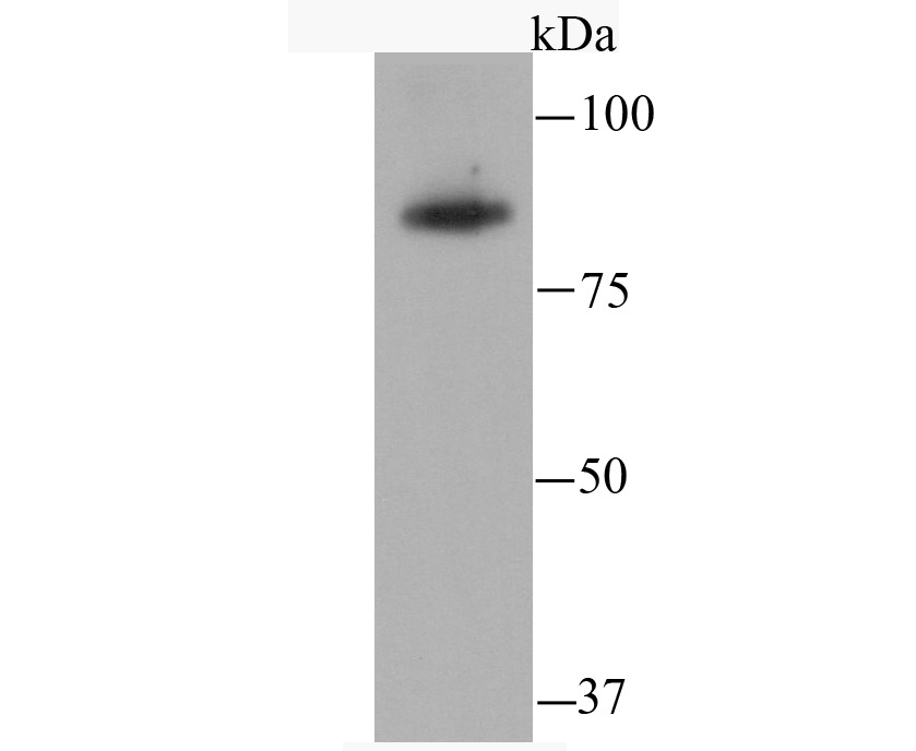 Anti-SATB2 Antibody (4X996)