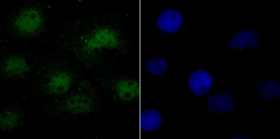 Anti-SRSF1 Antibody (4J752)