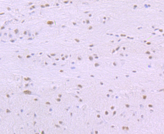 Anti-SF3B1 Antibody (5W363)