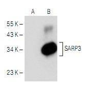 Anti-SFRP1 Antibody (2I224)