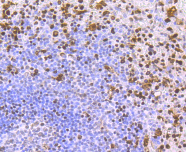 Anti-SAMHD1 Antibody (8T611)
