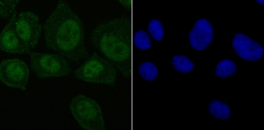 Anti-SET Antibody (3V307)