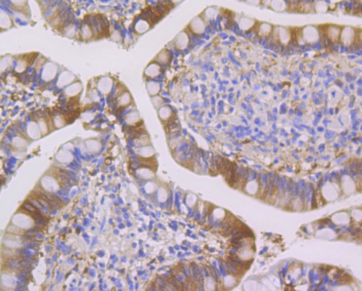 Anti-SENP1 Antibody (8Q886)