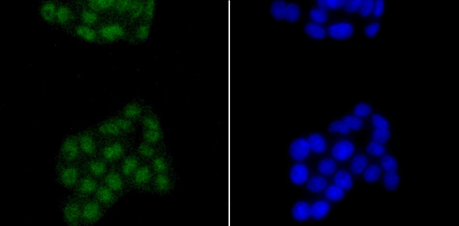 Anti-SATB2 Antibody (4X996)