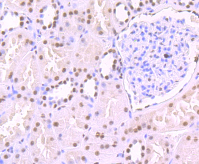 Anti-SF3B1 Antibody (5W363)