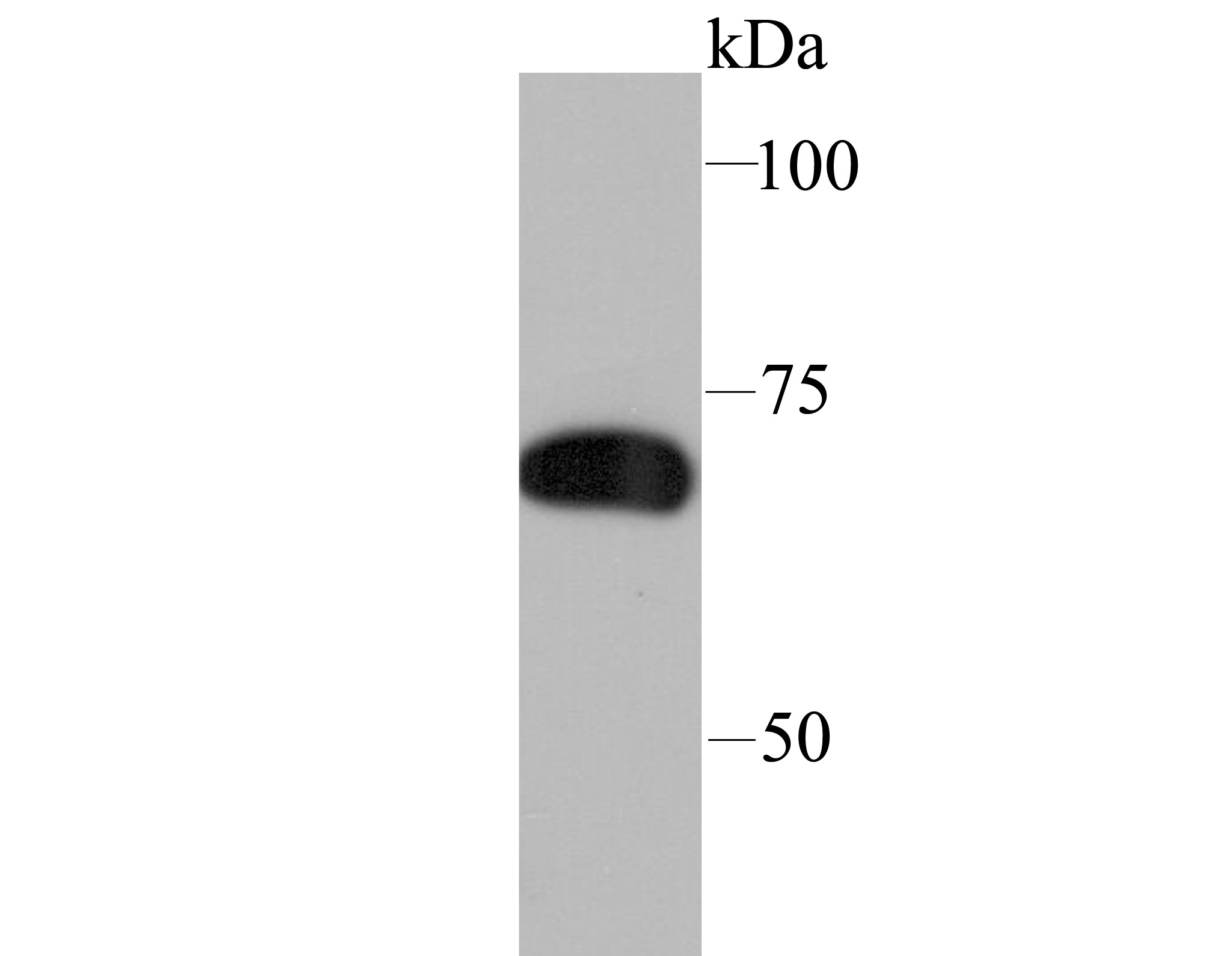 Anti-SAMHD1 Antibody (8T611)