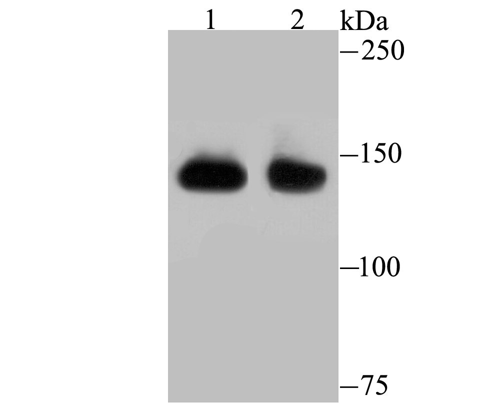 Anti-SF3B1 Antibody (5W363)