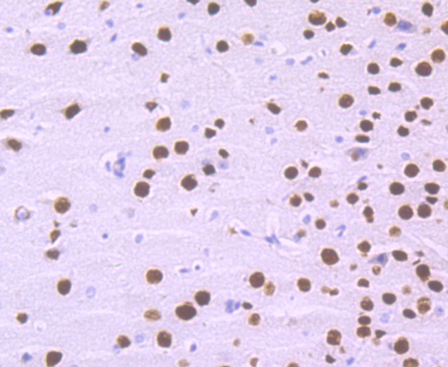 Anti-SATB2 Antibody (4X996)