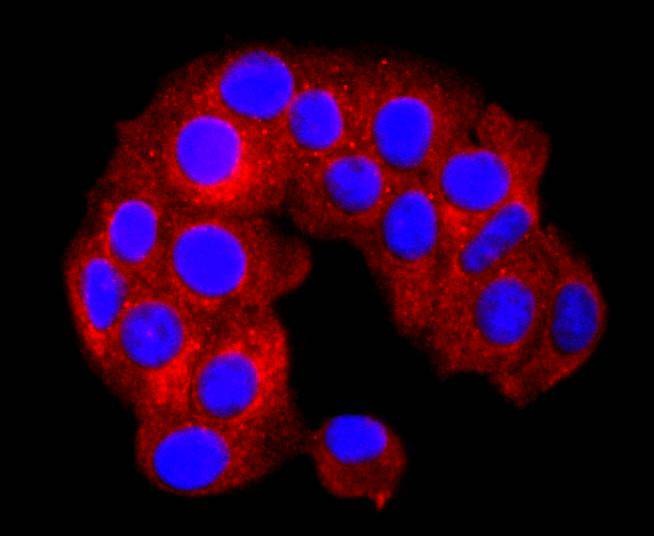 Anti-ATP2A2 Antibody (2R687)